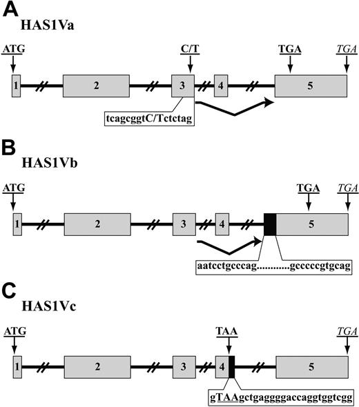 Figure 2. MM B cells express aberrant splice variants of HAS1. A schematic representation of HAS1Va (A), HAS1Vb (B), and HAS1Vc (C). ▦ represents exons, while ▪ indicates retained fragments of intron 4. Introns are shown with solid lines. Original stop codons of each novel variant are marked with italic letters, while bold uppercase letters indicate start codons and PTC. (A) HAS1Va: Point mutation 7760C>T detected in this novel variant transcript is shown in bold, uppercase letters; PTC is located 56 nucleotides downstream of deleted exon 4. (B) HAS1Vb is the result of deletion of the entire exon 4 and partial retention of intron 4 (59 bp; 12 first and last nucleotides of retained introns are shown) at the 5′ end of exon 5. These aberrations harbored PTC 93 nucleotides downstream of the retained intron 4. (C) HAS1Vc intronic splice variant is similar to HAS1Vb and is the result of the retention of 26 nucleotides of intron 4, causing insertion of a PTC, TAA, at the 3′ end of exon 4. The 26 nucleotides of retained intron 4 are shown on the figure. PTC is shown in bold uppercase letters.
