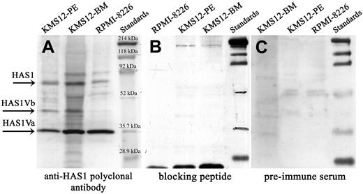 Figure 4. Expression of HAS1 and novel variant genes and proteins in MM cell lines. Western blot analysis. Protein lysates of MM cell lines were separated on SDS-PAGE, blotted onto nitrocellulose, and probed with (A) anti-HAS1 antibodies, (B) preincubated anti-HAS1 with blocking peptide, and (C) before bleed (preimmume serum). Arrows identify HAS1Va, about 35.9 kDa; HAS1Vb, about 39.5 kDa; and HAS1, about 65 kDa bands. The size of HAS1Va (about 35.9 kDa) and HAS1Vb (about 39.5 kDa) proteins were predicted using the ExPASy Molecular Biology Server. The anti-HAS1 specificity was evaluated by preincubating anti-HAS1 serum with the blocking peptide overnight before probing the membrane. The extra bands presented on the blot most likely are bands corresponding to HAS1 proteins encoded by other yet to be identified variants, and/or these bands represent the HAS proteins subjected to posttranslation modifications and glycosylation.
