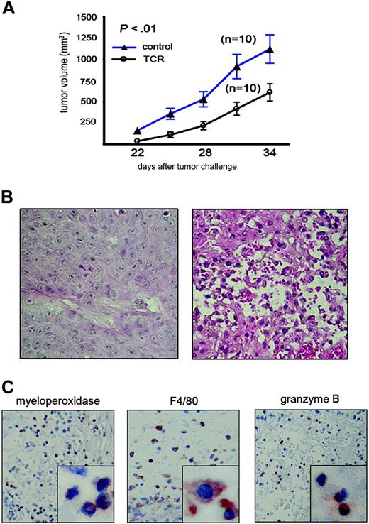 Figure 5. SCID mice reconstituted with transduced BM cells can control the growth of the MUC1-positive tumor xenograft. (A) Control (▴) or scTCR-reconstituted (○) mice were injected subcutaneously with 2 × 106 HPAF (MUC1-positive) tumor cells. Tumor size is shown on the y-axis while days after tumor challenge is plotted on the x-axis. P values were calculated by running t test using Microsoft Excel software. Data are presented as mean ± SE. (B) H&E staining of HPAF tumor sections from control mice (left) or from scTCR-reconstituted mice (right). (C) Staining of tumor sections from scTCR-reconstituted mice for myeloperoxidase (neutrophil marker), F4/80 (monocyte/macrophage marker), or granzyme B (NK cell marker). Images were taken under × 20 magnification. Images in lower right squares were taken under × 100 magnification.