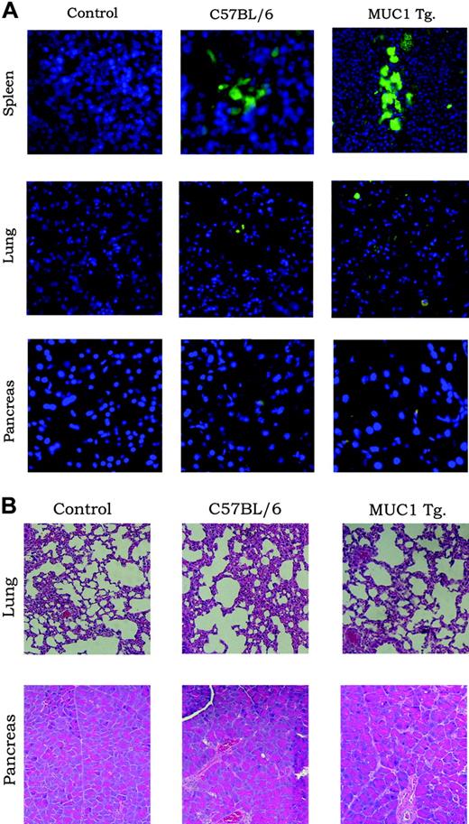 Figure 6. Expression of scTCR on immune cells has no deleterious effects on MUC1-positive normal tissues. (A) C57BL/6 (wild-type) and MUC1 Tg mice were reconstituted with BM cells transduced with the scTCR-EGFP MFG retroviral vector. Untreated mice served as controls. Spleen, lung, and pancreas were harvested 6 weeks after reconstitution and microscopically examined for infiltration with EGFP-positive cells (A) or stained with H&E (B) and examined for tissue destruction.