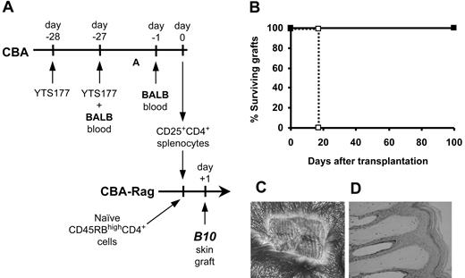 Figure 2. Activated alloantigen-induced CD25+CD4+ cells can regulate third-party skin allograft rejection. (A) Pretreatment and adoptive transfer protocol. CBA-Rag-/- mice were reconstituted with 105 CD45RBhighCD4+ cells with or without 2 × 105 CD25+CD4+ cells from CBA mice pretreated with 200 μg YTS177 and 250 μL BALB blood followed by a further dose of BALB blood the day prior to cell isolation. The reconstituted mice then received a B10 skin graft the following day. (B) Effect of CD25+CD4+ cells on CD45RBhighCD4+-mediated rejection of B10 skin grafts. □ CD45RBhighCD4+ cells only (MST, 17 days, n = 4); ▪ CD45RBhighCD4+ plus CD25+CD4+ cells (MST, > 100 days, n = 4; P < .05). (C) Representative skin graft 100 days after transplantation onto mouse reconstituted with both CD45RBhigh CD4+ and CD25+CD4+ cells. (D) Histology of graft in panel C (H&E).