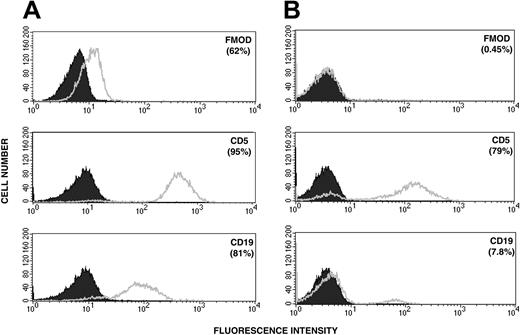 Figure 3. Intracytoplasmic staining for fibromodulin and surface-membrane staining for CD5 and CD19 of leukemic cells. (A) Patient with B-CLL and (B) PBMCs from a healthy control donor (1 representative experiment). The shaded curve represents background staining with a control antibody (see “Patients, materials, and methods”). Figures in brackets indicate percentages of positive cells.