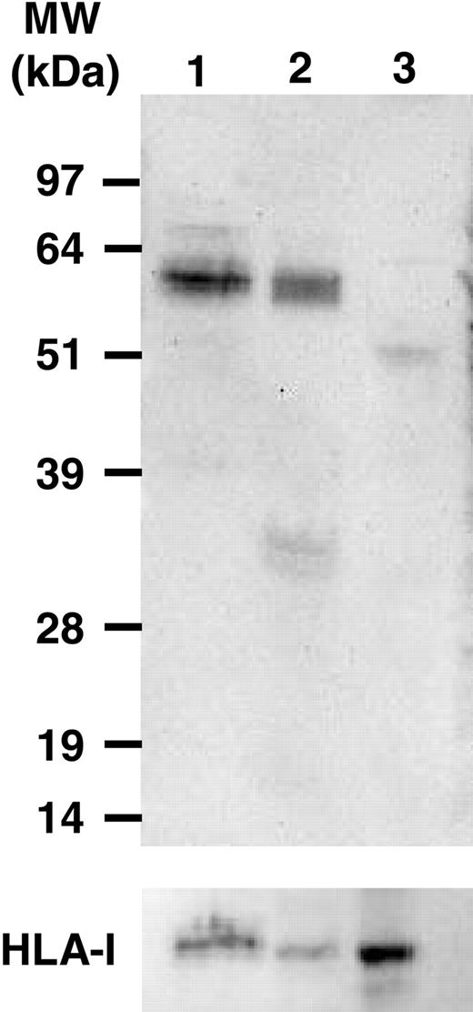 Figure 4. Representative immunoblots. Leukemic cell lysates of 2 B-CLL patients (lanes 1-2) and PBMCs of a normal healthy control donor (lane 3) incubated with anti-fibromodulin antibody (top) and anti-major histocompatibility complex (MHC) class 1 antibody (bottom) (see “Patients, materials, and methods”).