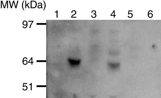 Figure 5. Immunoblotting (Western blot) of supernatants from cells cultured in AIM-V medium for 40 hours. Culture medium alone (lane 1), fibromodulin-positive (PCR) cell line (HFFF-PI 6) (lane 2), PBMCs of healthy donor (lane 3), B-CLL cells (lane 4), T cells of healthy donor (lane 5), and B cells of a healthy donor (lane 6). Molecular weight marker is to the left.