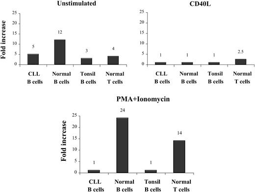 Figure 6. Fibromodulin expression in activated B and T lymphocytes, tonsil B cells, and B-CLL cells after 48 hours of culture. Increase was compared with time 0 hours measured by real-time quantitative PCR.
