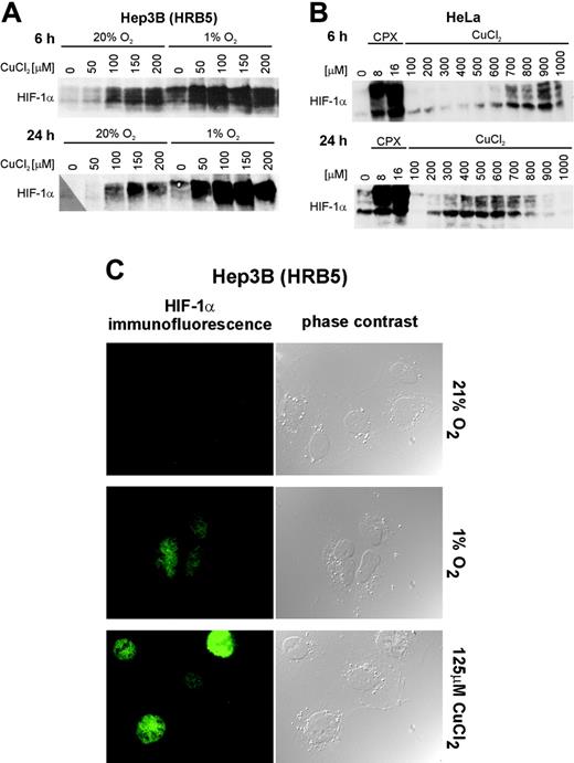 Figure 2. Nuclear HIF-1α protein induction following treatment with CuCl2. Hep3B hepatoma (subline HRB5) (A) and HeLa cervical carcinoma (B) cell lines were treated with the CuCl2 concentrations indicated for 6 and 24 hours. HIF-1α protein was detected by immunoblotting using a monoclonal anti-HIF-1α antibody. Hypoxia (A) and the iron chelator CPX (B) were used as positive controls. (C) Hep3B hepatoma cells (subline HRB5) were exposed to normoxic (20% O2) or hypoxic (1% O2) conditions or to 125 μM CuCl2 for 24 hours. The cells were prepared for indirect immunofluorescence analysis as described in “Materials and methods.” Original magnification, × 630.
