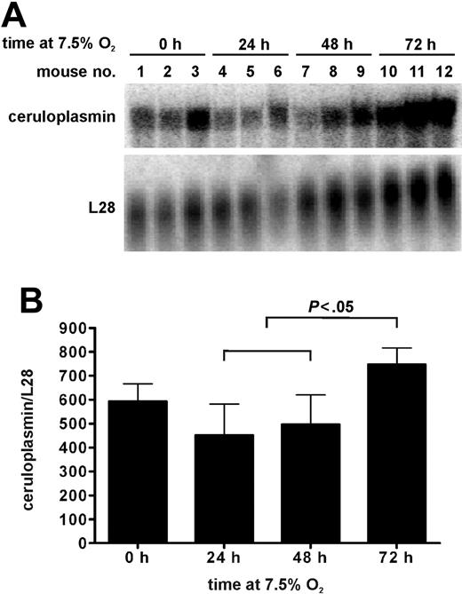 Figure 5. Ceruloplasmin mRNA levels in hypoxic mouse liver. (A) Northern blotting of liver RNA derived from mice exposed to 7.5% O2 for 0 to 3 days. Hybridization signals obtained with a ribosomal protein L28 probe served as a control for loading and blotting efficiency. (B) Phosphoimager quantification of band intensities shown in panel A. Mean ceruloplasmin to L28 mRNA ratios ± SD of n = 3 mice for each time point are given.