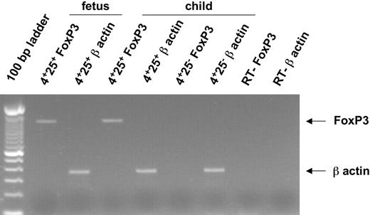 Figure 5. Expression of Foxp3 and β-actin mRNAs in human fetal thymocytes. Foxp3 mRNA and β-actin mRNA were amplified by RT-PCR from sorted CD8-CD4+CD25+ and CD8-CD4+CD25- thymocytes from a 24-month-old child and CD8-CD4+CD25+ thymocytes from a 14-WG fetus. Arrows indicate the specific PCR band corresponding to Foxp3 and β-actin mRNA.