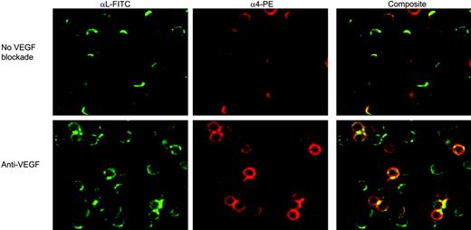 Figure 5. Effect of VEGF blockade on CLL-cell integrin clustering. CLL cells were prestained with nonblocking anti-αL-FITC or anti-α4-PE mAbs. After staining, cells were preincubated with the anti-VEGF blocking mAb before being placed on HUVEC monolayers, and filmed for 60 minutes using live cell imaging. The images shown were obtained after 5 minutes. In the absence of VEGF blockade, both α4 and αL were clearly polarized on most cells (top row), and this polarization was markedly reduced in the presence of the blocking anti-VEGF mAb (bottom row). Similar results were obtained when the SU5416 inhibitor was used to inhibit VEGF (data not shown). Comparable staining was observed throughout the 60 minutes of culture. These images are representative of 3 experiments in 3 separate patients, and the results for coclustered α4 and αL (composite staining) are shown quantitatively in Figure 6.