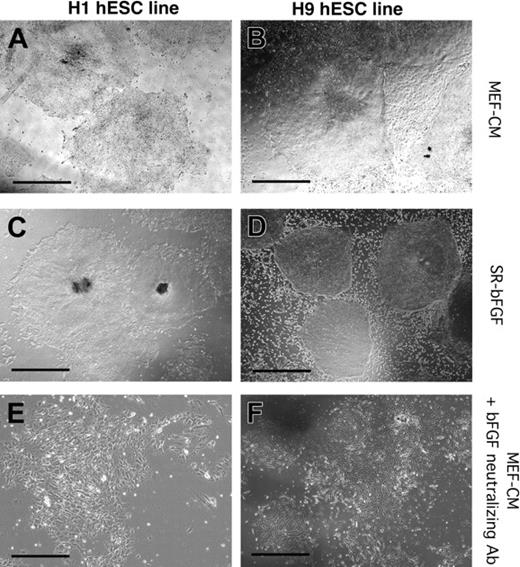 Figure 2. Maintenance of hESC lines H1 and H9 in SR-bFGF conditions and differentiation in response to neutralization of bFGF. H1 (A,C,E) and H9 (B,D,F) hESC lines were cultured in MEF-CM (A-B), SR-bFGF media (C-D), or in the presence of bFGF neutralizing antibody (E-F). The H1 hESC line was maintained in SR-bFGF media for more than 6 passages to date (C) and H9 hESC lines for more than 31 passages to date (D). Addition of bFGF neutralization antibody to hESC lines cultured in MEF-CM induced differentiation and loss of colony integrity. Scale bars = 200 μm.