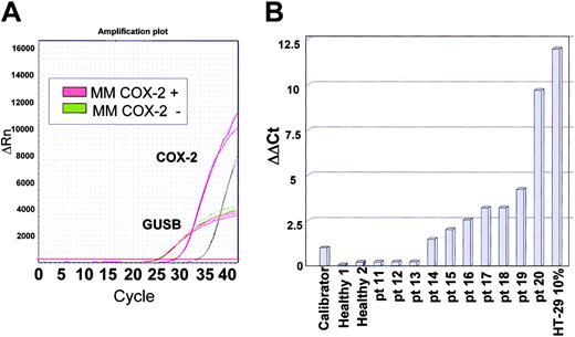 Figure 4. Real-time PCR assessment of COX-2 mRNA levels. (A) A representative example of COX-2 real-time PCR. Red lines are derived from a patient scoring COX-2 positive by WB, whereas green lines are from a patient scoring COX-2 negative. Although the housekeeping gene GUSB has identical amplification plots, there is a clear difference in the COX-2 mRNA expression level. (B) Results of 10 patients with MM. The calibrator sample for ΔΔCt analysis is a 0.5% HT-29 cell dilution. Negative controls are normal BM samples whereas the positive control is a 10% HT-29 cell dilution. Concordance with WB results is full, since patients 11 to 13 scored COX-2 negative by WB, whereas patients 14 to 20 scored COX-2 positive.