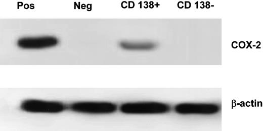 Figure 6. Western blotting on CD138-selected cell population. Positive control was the HT-29 cell line, negative was normal BM. The percentage of CD138+ cells was 99% in the CD138+ fraction and 0.3% in the CD138- fraction. The β-actin loading control is included. Pos indicates positive control; Neg, negative control (normal BM).
