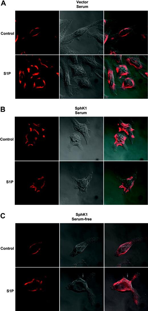Figure 6. Effect of expression of SphK1 on internalization of endogenous S1P1. RBL-2H3 cells stably expressing vector (A) or SphK1 (B) were cultured in the presence of 15% serum for 24 hours and then treated with vehicle or S1P (100 nM) for 30 minutes. Cells were fixed, incubated with anti-S1P1 primary antibody (1:100), and examined by confocal microscopy after staining with Texas Red-conjugated secondary antibody or by DIC to visualize the cells. (C) RBL-2H3 cells stably expressing SphK1 were cultured in serum-free medium for 24 hours and then treated as described for panels A and B. Right panels show merged pictures. Representative images from over 30 cells examined are shown.