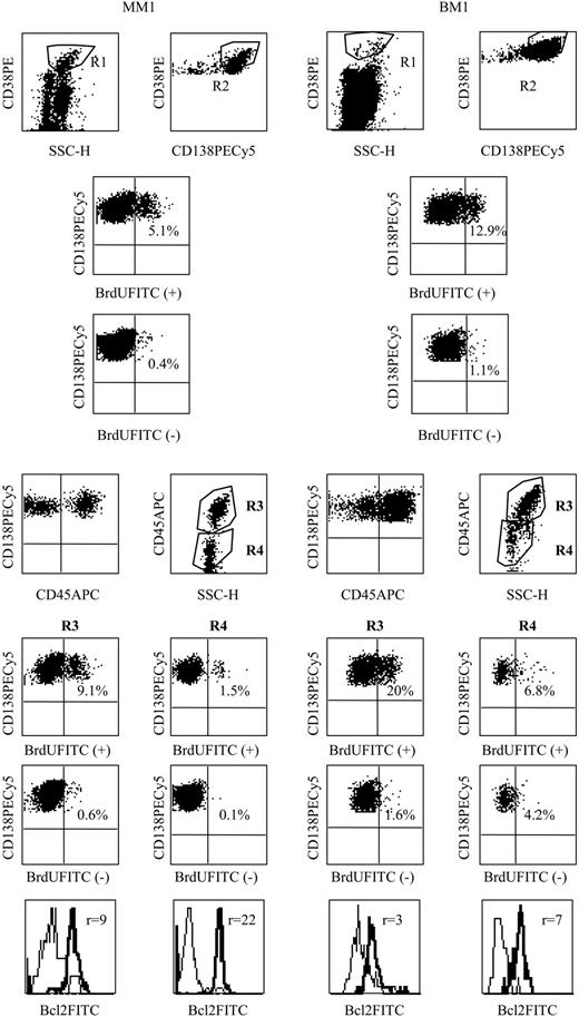 Figure 1. CD45 phenotype and LI of myeloma and bone marrow PCs. PC phenotype analysis was performed in 2 steps. In the first step, 15 000 total events were acquired to draw a PC gate in the side scatter (SSC)/CD38++ dot-plot (R1). In the second step, an acquisition of 15 000 PCs (at least 1000 PCs for very low plasmacytoses) was performed through the R1 live-gate. PCs were identified by coexpression of CD38 and CD138 (gate R2). A third region was set on the light scatter of the cells satisfying both R1 and R2 to exclude debris or apoptotic PCs with a low CD138 expression and a characteristic light-scatter distribution.12 The lack of Apo 2.7 staining in the gated population confirmed that cells were not apoptotic.15 Then 2 PC subpopulations were identified on the CD45 versus SSC dot plot: R3 was set around PC with a large SSC expressing a high level of CD45, while R4 was set around PC with low SSC and negative or weak CD45 expression. The analyses of the phenotype and the LI were performed in these 2 PC subpopulations, separately and simultaneously. The percentage of BrdU+ PCs within the population incubated with BrdU (BrdU+) or without (control, BrdU-) were indicated within the cytograms. For example, in patient MM1 the global LI was 1.7% (3.1%-1.4%) but 8.5% (9.1%-0.6%) in R3 and 1.4% (1.5%-0.1%) in R4. Overlay histograms represent the immunofluorescence of Bcl-2 (thick line) over the control (thin line). r indicates the ratio of MFI.