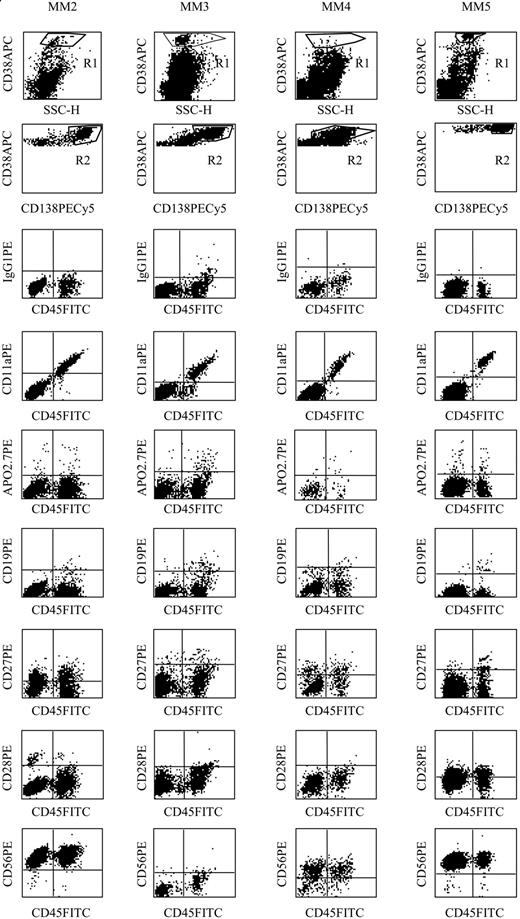 Figure 3. Phenotype of CD45bright myeloma cells. The phenotype of myeloma cells from 4 patients was determined in a 4-color assay. Myeloma cells were identified by coexpression of CD38 and CD138, and their phenotype (CD11a, CD19, CD27, CD28, CD56, Apo2.7) was analyzed in both CD45weak/neg and CD45bright subsets. Ig indicates immunoglobulin.