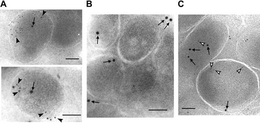 Figure 2. Immunogold studies localizing platelet FVIII in α-granules. Representative immunogold electron microscopy photographs of platelets from hB-FVIII/FVIIInull/VWF+/+ mice (A) or hB-FVIII/FVIIInull/VWF-/- mice (B-C) from a series of more than 50 photographs per study. Panels A and B were studies done with anti-human FVIII (10 nm gold beads, some indicated by arrows) and VWF (5 nm gold beads some indicated by closed arrowheads) as previously described.10,11 (C) Studies similar to panel B but the 5 nm gold particles represent detected murine fibrinogen (5 nm gold beads, some indicated by open arrowheads). The bar in each figure represents 0.1 μm.