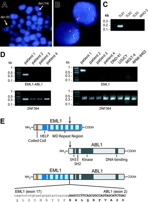 Figure 1. Identification of t(9;14)(q34;q32) and detection of EML1-ABL1 and TLX1 expression. (A) FISH with 5′ ABL1 (green signal) and 3′ ABL1 (red signal) probes on metaphase cells of the T-ALL patient with the cryptic t(9;14)(q34;q32). The translocation causes separation of the 2 probes with the 5′ ABL1 probe hybridizing to der(9) and the 3′ ABL1 probe hybridizing to der(14). (B) FISH with CDKN2A probe (red signal) and chromosome 9 centromere probe (green signal) on interphase cells of the patient with t(9;14)(q34;q32). The absence of a second red signal in each cell is caused by hemizygous CDKN2A deletion. FISH data were collected on a Leica DMRB (Wetzlar, Germany) fluorescence microscope equipped with a triple band-pass filter and a cooled black and white charged couple device camera (Photometrics, Tuscon, AZ) run by Quips SmartCapture FISH Imaging Software (Vysis, Downers Grove, IL). (C) Detection of TLX1 transcripts in the patient with t(9;14) by RT-PCR. TLX2, TLX3, or NKX2-5 transcripts were not detected in this patient. (D; Left) RT-PCR detection of the EML1-ABL1 fusion transcript in the patient with t(9;14) (patient 1) and absence of these fusion transcripts in 3 other T-ALL patients (patients 2-4). (Right) RT-PCR analysis of EML1 expression in the 4 patient samples analyzed in the left part of the figure and in 4 T-ALL cell lines. ZNF384 was amplified as a control of RNA quality. (E) Schematic representation of the EML1, ABL1, and EML1-ABL1 fusion proteins. The sequence of the in-frame fusion between exon 17 of EML1 and exon 2 of ABL1 is indicated at the bottom. SH3 indicates Src homology 3.