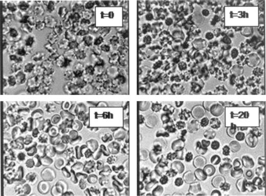 Figure 3. Morphologic appearance of fresh, unfixed samples of initially profoundly dehydrated RBCs at different times of incubation in culture media. RBCs in culture medium were observed under phase contrast at × 630 (Zeiss photomicroscope III RS; Zeiss Planapo objective lens, ×63 magnification, 1.4 numerical aperture). Photographs were taken with a JVC color video camera, TK-C1381. Note the gradual appearance of smooth, flattened discs, some with typical biconcave shape, indicating spontaneous rehydration of RBCs. This explains the developing heterogeneity apparent in the osmotic fragility curves of Figure 2B.