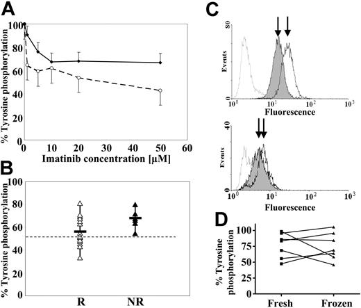 Figure 1. Inhibition of tyrosine phosphorylation in primary cells by imatinib mesylate. (A) Median levels of tyrosine phosphorylation in cytogenetic responders (□) and nonresponders (▪). 104 to 105 CD34+ cells per data point were treated for 2 hours with a range of imatinib mesylate concentrations, fixed in 1% paraformaldehyde, permeabilized with 0.3% saponin, and incubated with an antiphosphotyrosine (PY99; Santa Cruz, Holly Ditch Farm, United Kingdom) and a secondary fluorescent antibody (goat F(ab′)2 antimouse; Caltag, Silverstone, United Kingdom). The dose of imatinib mesylate which best distinguishes the 2 groups was found to be 20 μM. (B) Median percentage tyrosine phosphorylation of imatinib mesylate-treated cells from cytogenetic responders (R) and nonresponders (NR) compared with cells not exposed to the drug. The data show a significant difference between the median tyrosine phosphorylation of the 2 groups (Mann-Whitney test, P = .034). In about half of the patients responding to imatinib mesylate the tyrosine phosphorylation levels upon in vitro exposure to the inhibitor fell below 55% (dotted line) of that in the nonexposed cells, whereas this level of reduction was not achieved in any of the nonresponders. (C) Illustrative flow cytometric profile of 1 responder (top) and 1 nonresponder (bottom). Cells stained with the isotype control antibody (gray line) are used to adjust the flow cytometer settings, whereas cells not exposed to imatinib mesylate serve as a phosphotyrosine staining baseline for all measurements (black line). Imatinib mesylate-treated cells (shaded curve) from patients who eventually responded to imatinib mesylate show a clearly visible shift to the left, while the shift is significantly smaller for the nonresponders (as shown by the distance between the arrows pointing to the peak fluorescence of the exposed and nonexposed cells). (D) Comparison of CD34 cells used fresh or after 1 round of freezing for the assessment of total phosphotyrosine phosphorylation. From 7 extra patients, CD34+ cells from freshly collected blood were divided into 2 aliquots: 1 was placed in culture for the assay on “fresh” cells, and the second was cryopreserved and thawed later on for the same test. Each line depicts 1 paired sample of cells.