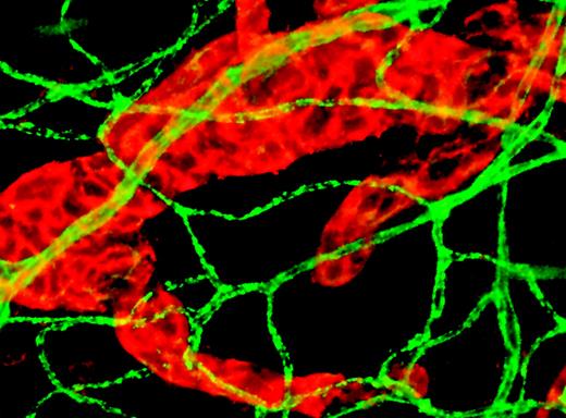Double staining of skin blood vessels (green) and lymphatic vessels (orange). See the complete figure in the article beginning on page 4642.
