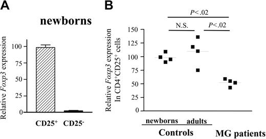 Figure 3. CD4+CD25+ thymocytes of patients with MG show decreased expression of Foxp3 mRNA. cDNA samples were obtained from CD4+CD25- and CD4+CD25+ thymocytes that had been purified using MACS magnetic microbeads and were subjected to real-time quantitative PCR using primers specific to FoxP3. The Foxp3 mRNA values were normalized to the 28S rRNA expression in each sample. (A) Quantification of relative Foxp3 mRNA levels for CD4+CD25- and CD4+CD25+ thymocytes from newborns. Error bars indicate SD value. (B) Quantification of relative Foxp3 mRNA levels in CD4+CD25+ thymocytes from newborns, young adults, and patients with MG.9. ▪ indicates 1 patient or 1 control. Bars represent mean values.
