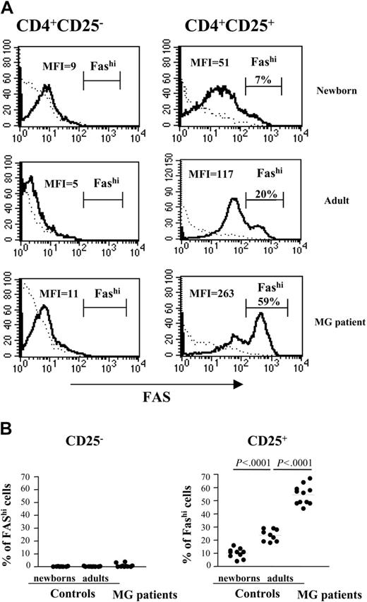 Figure 6. CD4+CD25+ thymocytes from patients with MG are enriched in Fashi cells. (A) Representative Fas expression profile for newborn, young adult normal, and myasthenic CD8-depleted thymocytes stained with anti-CD25, anti-CD95, anti-CD4 mAbs and analyzed by flow cytometry. The IgG isotype control staining is shown with a dotted line. The percentage of Fashi cells is indicated above the brackets delimiting this cell subset. (B) The percentage of Fas expression was determined among CD4+CD25- and CD4+CD25+ cells in thymi from 11 patients with MG, 9 young adults, and 10 newborns.