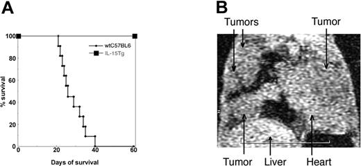 Figure 1. (A) Survival of IL-15 Tg mice following injection with MC38 cells. (A) Survival curve describing MC-38–injected IL-15 Tg mice. Two million MC38 cells,23 a murine colon carcinoma cell line, were injected via the tail vain into C57BL/6 mice or IL-15 Tg mice11 (n = 7), and their survival was monitored over 8 months. (B) MC38 cells formed lung metastases in the IL-15 Tg mouse following the NK-cell depletion. Anti-asialo GM1 antibody was injected into IL-15 Tg mice every 3 days (from day -9 to day 45) to deplete NK cells, which were occasionally monitored by analyzing the peripheral blood cells from mice by flow cytometry. Micro-MR (magnetic resonance) images were collected using a 1.5-Tesla superconductive magnet unit (Signa LX, WI). The arrows indicate the location of metastatic MC38 tumor masses in the lungs of an NK-depleted IL-15 Tg mouse.
