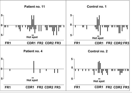 Figure 4. Mutations of cloned VκA27 sequences from 2 CVID patients (high and low mutated) and from 2 adult controls. Mutations in VκA27 are represented by 11 sequences randomly selected from each patient and control. Hot spot indicates the two Fnu4HI restriction sites in the CDR1. The columns illustrate the number of mutations in each codon; above the axis, preventing cleavage in the hot spot; below the axis, not affecting cleavage.