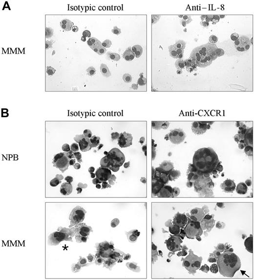 Figure 6. Effect of neutralizing anti–IL-8 or anti-CXCR1/anti-CXCR2 antibodies on the maturation of megakaryocytic cells derived from MMM CD34+ cells. Purified CD34+ cells from MMM and healthy subjects (NPB) were cultured for 14 days in serum-free medium containing a cytokine cocktail (9F or MK medium) in the absence or presence of neutralizing anti–IL-8 (panel A) or anti-CXCR1 or anti-CXCR2 (panel B) antibodies. The cells were cytocentrifuged and stained with May-Grünwald-Giemsa (magnification × 400). In panel B, the asterisk indicates the presence of MK cells with plump lobulated nucleus in MMM untreated cells, and the black arrow designates MK cells with polylobulated nucleus in the anti–IL-8– or anti-CXCR1 antibody–treated cultures in patients with MMM. Similar polylobulated nuclei were also obtained in anti-CXCR2 antibody–treated MMM cultures.