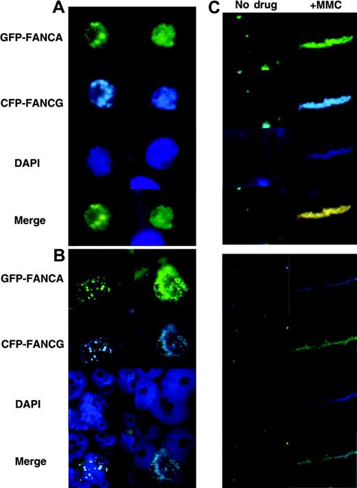 Figure 5. FA protein foci diffuse after MMC treatment. HeLa cells transfected with EFGP-FANCA/CFP-FANCG were treated for 24 hours with 0.1 μM MMC. (A) Whole cells, (B) chromatin, and (C) chromatin fibers were prepared and examined. FA proteins diffused on chromatin after MMC treatment.
