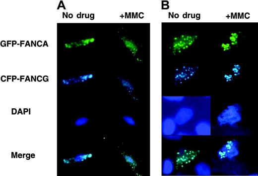 Figure 6. FA proteins exist as foci and diffuse on chromatin after MMC treatment in primary cells. Primary FA-A fibroblasts were transfected with EGFP-FANCA/CFP-FANCG and treated with 0.1 μM MMC for 24 hours. (A) Whole cells and (B) chromatin were prepared and visualized.