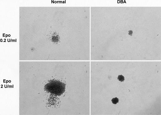 Figure 4. Effect of colony size on amplitude of erythroid output. The difference in amplitude of erythroid output between DBA and normal cells in liquid culture is caused primarily by a difference in colony size. Photomicrographs of representative colonies from normal and DBA cultures at limiting (0.2 U/mL) and standard (2 U/mL) concentrations of Epo show difference in colony size. Colonies were visualized using an Olympus CK40 inverted microscope equipped with an Olympus Camedia 3030 camera and a 10 ×/10 objective lens (Olympus, Southall, Middlesex, United Kingdom). Images were processed with Microsoft Photo Editor (Microsoft, Reading, United Kingdom).