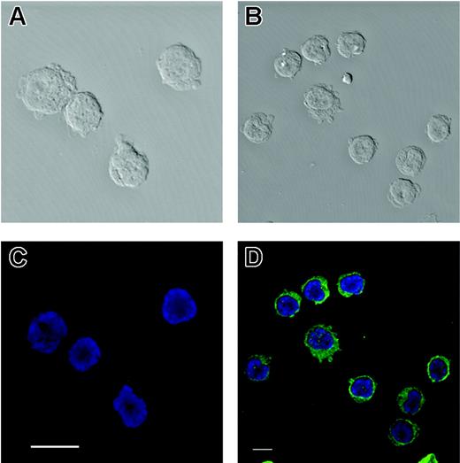 Figure 7. Confocal photomicrograph for hCNT3 in CLL cells. (A,C) Background staining of CLL cells reacted with an IgM isotype control antibody shown in phase contrast (A) or fluorescent confocal microscopy (C). (B,D) CLL cells reacted with hCNT3 monoclonal antibody shown in phase contrast (B) or fluorescent confocal microscopy (D) illustrating intense cytoplasmic staining by this antibody.