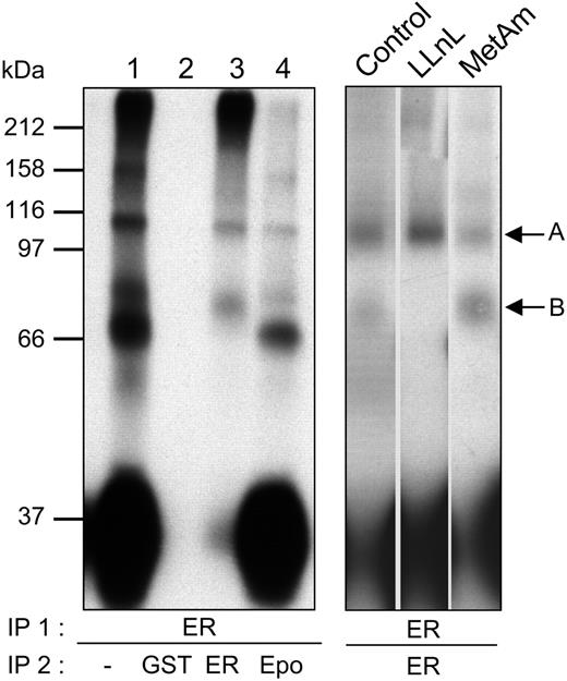 Figure 4. Degradation of the intracellular domain of the EpoR by proteasomes.(Left panel) UT-7 cells were incubated for 30 minutes with 125I-Epo. After washing to remove unbound radioactivity, the cells were lysed, and clarified cell extracts were cross-linked with 2 mM BS3. Excess cross-linking reagent was blocked with ethanolamine, and EpoRs (ER) were precipitated with a polyclonal antibody directed against the intracellular domain of the receptor (C-236). Immunoprecipitates (IP) were dissociated by boiling in SDS- and DTT-containing buffer. Parts of the eluted proteins were analyzed (lane 1). The remaining proteins, after removal of DTT and dilution in Nonidet P-40 (NP-40)–containing buffer, were reprecipitated successively with anti-GST (lane 2), C-236 anti-EpoR (lane 3), and anti-Epo (lane 4) antibodies. Immunoprecipitates were analyzed by polyacrylamide gel electrophoresis and autoradiography. (Right panel) UT-7 cells were preincubated for 15 minutes with no inhibitor (control), LLnL, or methylamine (MetAm) and stimulated for 30 minutes with125I-Epo. EpoR immunoprecipitates of cross-linked cell extracts were prepared as in left panel. Denatured immunoprecipitates were then immunoprecipitated with C-236 anti-EpoR antibodies and analyzed by polyacrylamide gel electrophoresis and autoradiography. Arrows A and B point to the 70 kDa and 40 kDa EpoR crosslinked to125I-Epo.