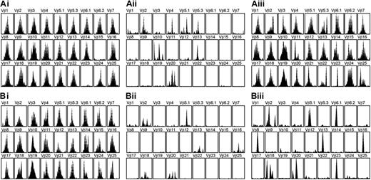 Figure 5. Profiles of TCRβ repertoire diversity before and after AHSCT. Profiles are shown for a patient with pretransplantation sjTREC level of more than 1200 copies/mL blood (A) and a patient with pretransplantation sjTREC level fewer than 1200 copies/mL blood (B). Profiles are shown before AHSCT (Ai, Bi), 1 month after AHSCT (Aii, Bii), and 6 months after AHSCT (Aiii, Biii).