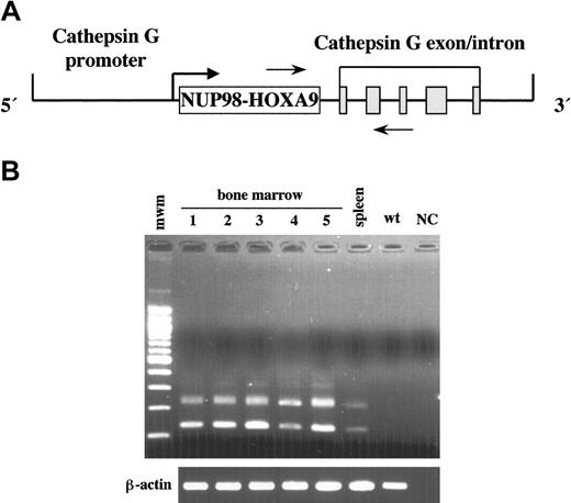 Figure 1. Generation of NUP98-HOXA9 transgenic mice. (A) The hCG-NUP98-HOXA9 transgenic construct. The NUP98-HOXA9 cDNA was inserted at the transcriptional start site of the hCG gene. The solid gray boxes represent the 5 exons of the hCG gene. The polyadenylation signal is provided by the hCG gene. The horizontal arrows indicate the location of RT-PCR primers. (B) RT-PCR analysis of bone marrow RNAs obtained from the transgenic mice of 5 lines (1, line 60; 2, line 131; 3, line 1514; 4, line 1583; 5, line 1589) and spleen of line 1589. Lines 131 and 1589 were used for further analysis. Two different kinds of transcripts were created due to alternative splicing of cathepsin G exons. β-actin was amplified from the same samples to check for RNA quality. mwm indicates 100 base pair (bp) ladder; wt, bone marrow of the wild-type mouse; and NC, negative control.