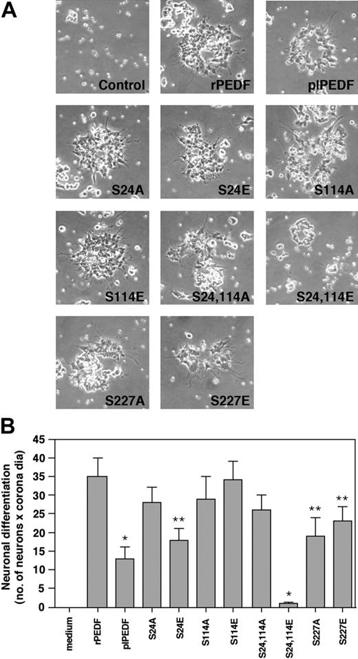 Figure 5. The effect of rPEDF, plPEDF, and the various rPEDF mutants on PEDF neurotrophic activity. The cells (2.5 × 105 cells/mL) were incubated with rPEDF, plPEDF, or the various rPEDF mutants (all at 20 nM) in MEM supplemented with 2 mM l-glutamine, antibiotics, and 0.1% 5 mg/mL insulin, 5 mg/mL transferrin, 5 mg/mL selenium (ITS). After 7 days in culture, the cells were transferred onto poly-d-lysine–coated plates, and their morphology and differentiation state were monitored by inverted microscope (Nikon TE 2000U connected to DUC camera) at various periods of time. The Y-79 morphology at 10 days after attachment is shown. (B) Quantitative analysis of the results presented in panel A is presented as a mean ± SD of 6 distinct experiments. Student t test was used to analyze statistical significance of the differences between cells treated with rPEDF and cells treated with the various PEDF forms (*P < .01; **P < .05). dia indicates diameter.