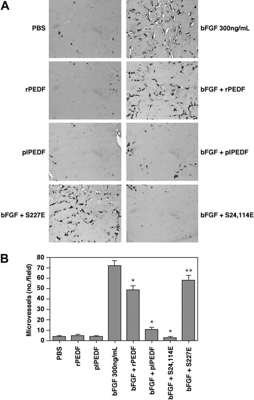 Figure 7. The antiangiogenic activity of the various rPEDF forms on bFGF-induced neovascularization in the in vivo Matrigel plug assay. A) CD-1 nude mice were subcutaneously injected with 0.5 mL Matrigel containing rPEDF, plPEDF, S24, 114E mutant, and S227E mutant (all at 20 nM) in the presence or absence of bFGF (300 ng/mL). Control plugs were combined with PEDF (20 nM) or bFGF (300 ng/mL) only. After 7 days, mice were killed and Matrigel plugs were excised, fixed in 4% formaldehyde, embedded in paraffin, sectioned, and stained. Representative fields of H&E staining of thin sections from Matrigel plugs of each arm of the experiments were taken using light microscope (Nikon E600 connected to DxM 1200 F camera) (× 40 magnification). (B) Angiogenesis was measured by counting the number of blood vessels/field for 3 different cross-sectional areas of each Matrigel plug. Student t test was used to analyze statistical significance of the differences between plugs treated with bFGF and plugs treated with the combination of bFGF and the various PEDF forms (*P < .01; **P < .05; n = 3).