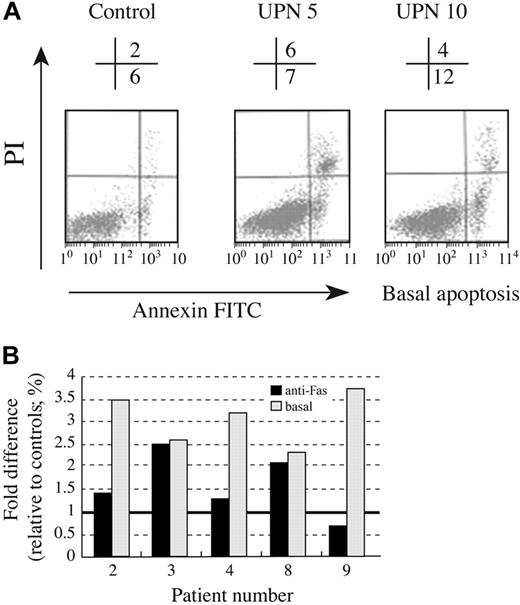 Figure 4. Increased apoptosis in AD DC lymphocytes. Lymphocytes from 5 AD DC subjects and age-matched controls were examined for apoptosis by FACS. (A) Sample FACS profile of basal apoptosis for lymphocytes cultured 10 days, representing 2 AD DC subjects and 1 control. The percentage of apoptotic cells (FITC positive) is shown above the FACS histogram. (B) Summary data for 5 AD DC subjects. Basal and Fas-mediated apoptosis is expressed as percent difference of FITC gated AD DC cells relative to age-matched controls, as described in “Patients, materials, and methods.” Bold line on y axis represents control level.