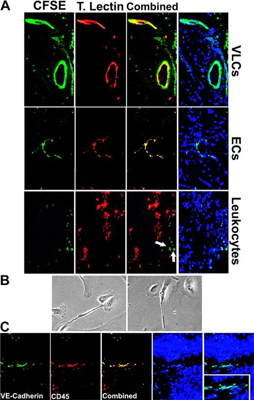 Figure 2. VLCs have the capacity to generate functional blood vessels in vivo. (A) CFSE-labeled VLCs injected in Matrigel plugs into immunodeficient mice assembled into tomato lectin–perfusioned, Cy3-labeled blood vessels within 2 weeks. Combined image of CFSE-labeled cells and counterstaining with DAPI (4′,6-Diamidino-2-phenylindole) is also shown (magnification, × 200). CD45-VE-cadherin+ cells (ECs) also form functional neovessels, whereas CD45+VE-cadherin- cells (leukocytes) sorted from the same specimen remain as individual cells and do not partake in the formation of blood vessels assembled by host cells in the periphery of the Matrigel plugs (arrows). (B) VLCs cultured on fibronectin-coated plates in endothelial cell growth media developed cytoplasmic projections and intercellular junctions after 2 weeks. (Magnification, × 200.) (C) Capillaries in human tumors harbored CD45+ cells coexpressing the endothelial marker VE-cadherin. (Magnification, × 200.)