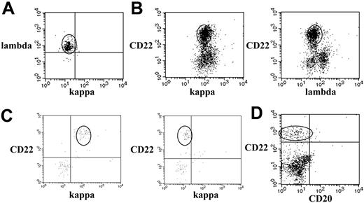 Figure 1. Flow cytometric dot plots of cerebrospinal fluid specimens demonstrating lymphoma populations. Each dot represents a single cell. The units on the x- and y-axes are relative fluorescent intensity. (A) Monoclonal B-cell population. All lymphoma cells in the oval area are λ-positive (y-axis) and κ-negative (x-axis). (B) Surface immunoglobulin-negative or dim B-cell lymphoma. The B cells in the oval area are CD22+ (y-axis) and negative for κ on the left and λ on the right (x-axis). (C) Small population of monoclonal B cells in a specimen with low cellularity. The B cells in the oval area are CD22+ (y-axis) and κ-positive (left, x-axis) and λ-negative (right, x-axis). (D) CD20– B-cell lymphoma. The B cells in the oval area are CD20– (x-axis) and CD22+ (y-axis) and monoclonal (not shown). The CD22– and CD20– cells are T cells.