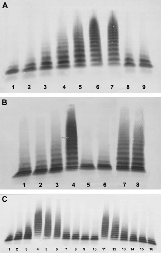 Figure 1. Determination of ADAMTS13 activity and detection of inhibitors by immunoblotting of VWF substrate degraded by BaCl2-activated ADAMTS13. (A) ADAMTS13 activity in 1:20 diluted patient serum or plasma. Lanes 1-6, assay calibration by normal plasma (NHP) dilutions of 1:20 (100% activity), 1:40 (50%), 1:80 (25%), 1:320 (6.25%), 1:640 (3%), and buffer control (0%). Lane 7, propositus (premortem serum); lane 8, father (plasma); lane 9, mother (plasma). (B) ADAMTS13 inhibition by purified immunoglobulin (Ig) and Ig-depleted hemolytic serum. Residual ADAMTS13 activity of NHP incubated 1:1 (vol/vol) with concentrated total Ig purified from the propositus' serum, or with concentrated Ig-depleted hemolytic serum (final NHP dilution, 1:20). Lanes 1-4, assay calibration by NHP dilutions of 1:20 (100% activity), 1:40 (50%, equivalent to an inhibitor titer of 1 BU/mL), 1:80 (25%), and buffer control (0%). Lanes 5-6, NHP 1:1 (vol/vol) with purified Ig (duplicates); lanes 7-8, NHP 1:1 (vol/vol) with Ig-depleted serum (duplicates). (C) Inhibition of ADAMTS13 activity by hemoglobin. Residual ADAMTS13 activity of NHP incubated 1:1 (vol/vol) with recombinant or erythrocyte-derived human hemoglobin (final NHP dilution, 1:20). Lanes 1-4, assay calibration by NHP dilutions of 1:20 (100% activity), 1:40 (50%, equivalent to an inhibitor titer of 1 BU/mL), 1:80 (25%), and buffer control (0%). Lanes 5-10, NHP incubated 1:1 (vol/vol) with recombinant hemoglobin; lanes 11-16, NHP incubated 1:1 (vol/vol) with purified hemoglobin from lysed erythrocytes. Final hemoglobin concentrations are 20 g/L (lanes 5, 11), 10 g/L (lanes 6, 12), 5 g/L (lanes 7, 13), 2 g/L (lanes 8, 14), 1 g/L (lanes 9, 15), and 0.5 g/L (lanes 10, 16).