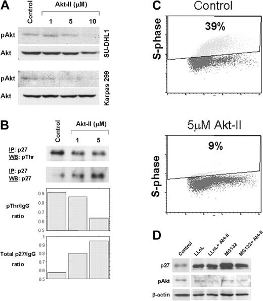 Figure 1. Inhibition of Akt increases total p27 levels and induces cell-cycle arrest in ALCL cells. (A) Akt-II inhibitor induced gradual decrease of pAkt (serine 473) levels. At a concentration of 10 μM, Akt-II induced almost complete absence of pAkt at 12 hours. Total Akt was also probed using the same membrane. No substantial changes were noticed in Akt levels. Top panel, SU-DHL1; bottom panel, Karpas 299. (B) Immunoprecipitation studies revealed a decrease in threonine phosphorylation of p27 (top panel) and an increase in total p27 levels in Karpas 299 cells treated with Akt-II inhibitor at 12 hours. WB indicates Western blot; and IP, immunoprecipitation. Densitometry of the immunoblot bands showed a substantial decrease in the threonine-phosphorylated p27/immunoglobulin G (IgG) ratio that was associated with increased total p27/IgG ratio. (C) Cell cycle analysis using BrdU uptake and flow cytometry in Karpas 299 cells 24 hours after treatment with Akt-II inhibitor. The S-phase fraction was 9% in cells treated with 5 μM of the Akt-II inhibitor compared with 39% in untreated (control) cells. Similar results were obtained for SU-DHL1 cells. (D) Total p27 levels after proteasome inhibition in ALCL cells. Treatment of Karpas 299 cells with LLnL and MG132 proteasome inhibitors for 16 hours resulted in a significant increase of total p27 levels (lanes 2 and 4 compared with lane 1), due to decreased p27 degradation through the ubiquitin-proteasome system. LLnL and MG132 were used at a concentration of 35 μM each and were previously shown to adequately block proteasome activity (data not shown). Pretreatment of ALCL cells with proteasome inhibitors for 4 hours followed by treatment of cells with both proteasome inhibitors and Akt-II for 12 hours resulted in no additional increase of total p27 levels (lanes 3 and 5), which demonstrates complete blockade of proteasome-mediated degradation.