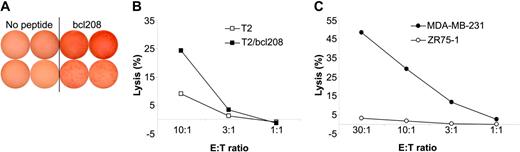 Figure 5. Cytolytic capacity of Bcl-2–specific CTLs. bcl208-reactive CTLs were isolated from PBLs from a breast cancer patient using HLA-A2/bcl208-coated magnetic beads. (A) A small fraction of these cells was cloned by limiting dilution and expanded. Response of 2 such clones (top and bottom rows) as measured in a GrB ELISPOT against no peptide or the bcl208 peptide. Each experiment was performed in duplicate with 103 effector cells/well. (B) The isolated bulk culture was analyzed for specific lysis of T2 cells with (▪) or without (□) bcl208 peptide. (C) Lysis by bcl208-isolated T cells of the HLA-A2–positive breast cancer cell line MDA-MB-231 (•) and the HLA-A2–negative breast cancer cell line ZR75-1 (○). E/T indicates effector-target ratio.