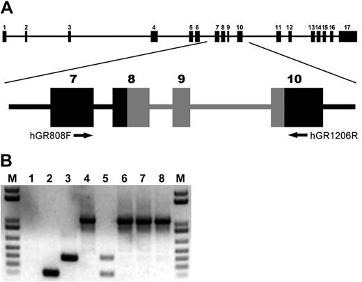 Figure 2. Myeloid-restricted expression of the Δ319 G-CSFR mutant. (A) Location of primers for analysis of genomic and cDNA. The G-CSFR intron-exon structure is shown with the locations of the primers used in panel B for PCR amplification. (B) Analysis of genomic and cDNA from patient and parent cells. The 1039-bp and 332-bp products correspond to the WT and Δ319 G-CSFR forms, respectively, obtained with genomic DNA. Amplification with cDNA yields 398-bp and 207-bp products corresponding to the WT and Δ319 G-CSFR, respectively. (Lane 1) Water (negative control); (lanes 2,3) plasmid DNA from Δ319 and WT clones; (lane 4) DNA from patient's fibroblasts showing only the WT G-CSFR; (lane 5) cDNA from patient's neutrophils; (lanes 6,7) genomic DNA from both parents); and (lane 8) genomic DNA from unrelated donor.