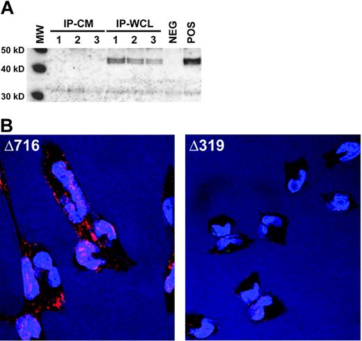 Figure 3. Intracellular accumulation of the Δ319 G-CSFR. (A) Immunoblot analysis of the G-CSFR in conditioned media (CM) or whole cell lysates (WCLs) fromΔ319 transfectants. CM or lysates were prepared from CHO cells transfected with theΔ319 G-CSFR fused to a Myc-epitope tag. The samples were immunoprecipitated with an anti-Myc antibody and immunoblotted with anti–G-CSFR antibody recognizing aa 25 to 200 of the G-CSFR (sc9173). Samples are from 3 independent Δ319 clones. (Lanes 1-3) CM from the 3 different clones; samples; (lanes 4-6) WCLs from the same samples; Neg indicates untransfected cells as a negative control; Pos, WCLs from transiently transfected CHO cells as a positive control. (B) Subcellular localization of the Δ319 G-CSFR. CHO cells transfected with the Δ716 G-CSFR (left) which accumulates at the cell surface or the Δ319 G-CSFR (right) were grown on glass coverslips for 48 hours, incubated with anti–G-CSFR (sc9173), washed, then stained with Alexa633-conjugated anti-rabbit antibody (red), followed by Hoechst stain for nuclei (blue). Cells were visualized on a Zeiss LSM 510 multiphoton confocal microscope at × 400 amplification.