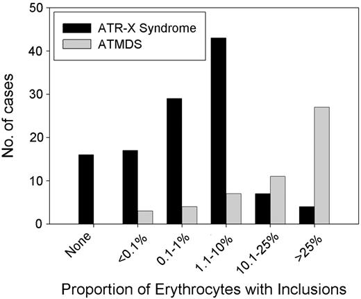 Figure 6. Distribution of the proportion of HbH in the peripheral blood in ATMDS compared with ATR-X syndrome. Results of supravital staining have been reported in 61 patients with ATMDS, and the number of inclusion-containing cells has been quantified in 54 patients. Of these, 17 (31%) patients have had 50% or more circulating erythrocytes containing HbH inclusions, 22 (44%) have had 10% to 50% of such cells, and 15 (28%) patients have had 10% or less (median, 30%). Only 8 (17%) of 48 quantified cases have had 25% or more HbH when measured by electrophoretic or chromatographic methods (data not shown), and in 10 patients the amount of HbH was below the level of detection despite the presence of small numbers of inclusions on supravital staining (mean, 15%). Several patients with ATR-X syndrome have no HbH, whereas all patients with ATMDS have some. This is because, by definition, patients with ATMDS must have some evidence of HbH, but ATR-X syndrome may be diagnosed from other characteristic nonthalassemic features of the multisystemic disorder in the presence of an ATRX gene mutation.