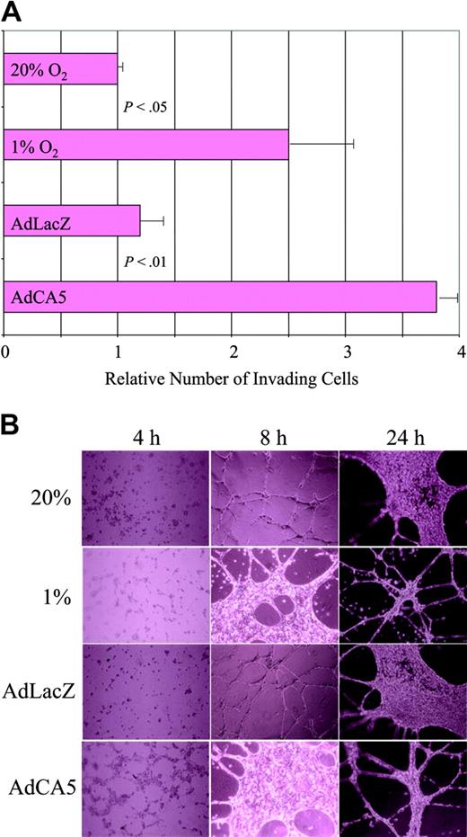 Figure 4. Effect of hypoxia and AdCA5 on invasion and tube formation by endothelial cells. (A) Matrigel invasion by ECs exposed to hypoxia or AdCA5. ECs were incubated for 24 hours in the presence or absence of adenovirus (5 pfu/cell), transferred to a Matrigel-coated membrane in a Boyden chamber, and exposed to 20% or 1% O2 for 24 hours, and the number of cells that had invaded through the Matrigel to the underside of the filter was counted. Three independent experiments were performed and the results for each condition were normalized to the result obtained for untreated cells (20% O2). P values were determined from the mean and standard deviation (shown) using Student t test. (B) Tube formation by ECs exposed to hypoxia or AdCA5. ECs were plated on Matrigel in the absence or presence (5 pfu/cell) of adenovirus (AdLacZ or AdCA5) that was added to the medium at the time of plating. Adenovirus-infected cells and one set of uninfected cells were incubated under nonhypoxic conditions (20% O2), whereas another set of uninfected cells was incubated under hypoxic conditions (1% O2). The cultures were analyzed 4, 8, and 24 hours after plating by phase-contrast microscopy. Each condition was performed in triplicate in 2 independent experiments and representative fields are shown.