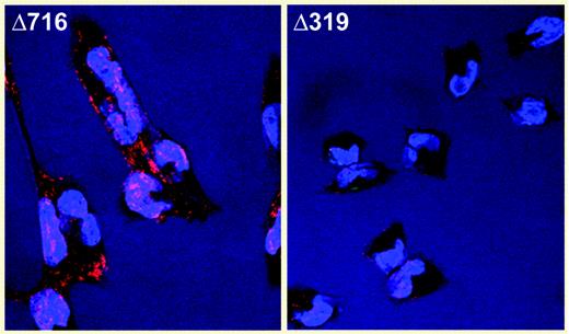 Intracellular accumulation of the Δ319 G-CSFR. See the complete figure in the article beginning on page 584.