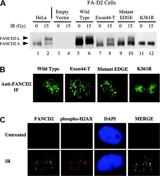 Figure 3. FANCD2 carboxy terminal mutants are monoubiquitinated following ionizing radiation. (A) FA-D2 fibroblasts were stably transduced with either hemagglutinin (HA)–pMMP (empty vector), HA-FANCD2 (wild type), HA–Exon44-T, or HA–mutant-EDGE, as indicated. Cells were irradiated with 15 Gy, as indicated, and whole-cell lysates were immunoblotted with anti-FANCD2 antisera. (B) Immunofluorescence of the transduced cells 8 hours after cellular exposure to IR, using an anti-FANCD2 antiserum. (C) Colocalization of FANCD2 and phosphorylated histone H2AX in DNA damaged-inducible foci. HeLa cells were either untreated (top) or exposed to IR (15 Gy, 15 hours) (bottom), as indicated. HeLa cells were double-stained with monoclonal anti-FANCD2 (FI-17; green) and polyclonal anti–histone γ-H2AX (Ser139; red). Merges of corresponding anti-FANCD2 and anti–histone γ-H2AX images are shown. Original magnifications × 630 (B-C).
